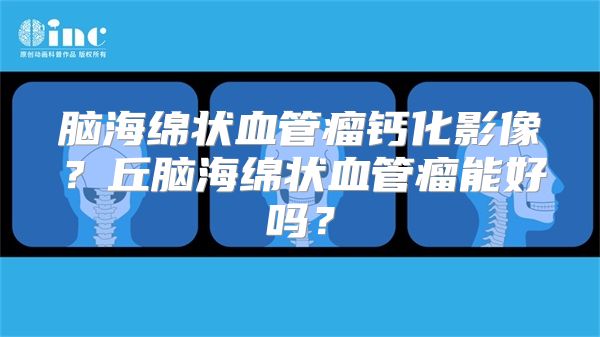 脑海绵状血管瘤钙化影像？丘脑海绵状血管瘤能好吗？