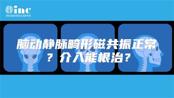 脑动静脉畸形磁共振正常？介入能根治？