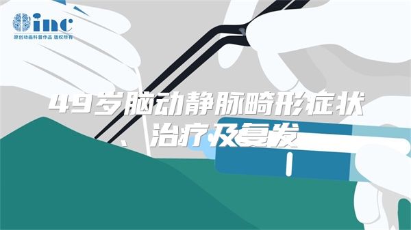 49岁脑动静脉畸形症状、治疗及复发