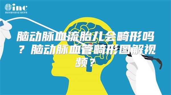 脑动脉血流胎儿会畸形吗？脑动脉血管畸形图解视频？