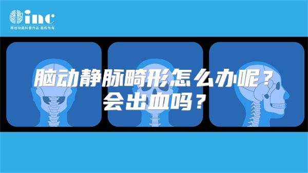 脑动静脉畸形怎么办呢？会出血吗？