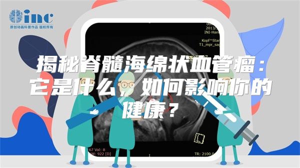 揭秘脊髓海绵状血管瘤：它是什么，如何影响你的健康？