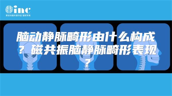 脑动静脉畸形由什么构成？磁共振脑静脉畸形表现？