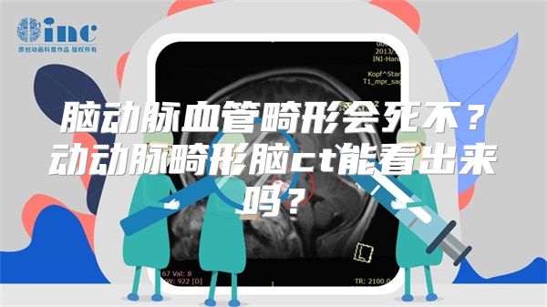 脑动脉血管畸形会死不？动动脉畸形脑ct能看出来吗？