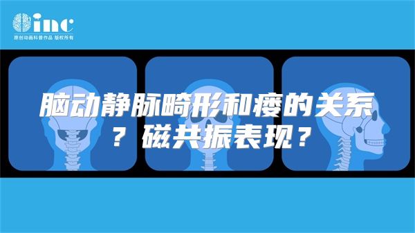 脑动静脉畸形和瘘的关系？磁共振表现？