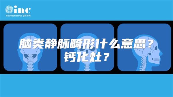 脑类静脉畸形什么意思？钙化灶？