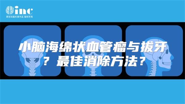 小脑海绵状血管瘤与拔牙？最佳消除方法？