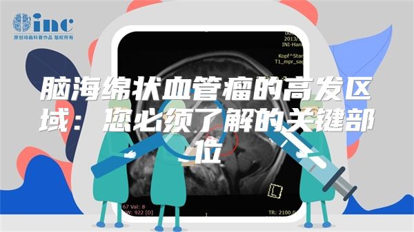 脑海绵状血管瘤的高发区域：您必须了解的关键部位