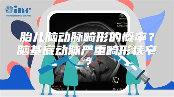 胎儿脑动脉畸形的概率？脑基底动脉严重畸形狭窄？